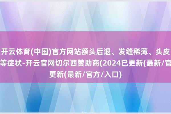 开云体育(中国)官方网站额头后退、发缝稀薄、头皮出油加重等症状-开云官网切尔西赞助商(2024已更新(最新/官方/入口)